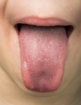 tongue diagnosis for Acupuncture at Quay Health Sydney